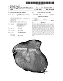 ENHANCED CORONARY VIEWING diagram and image