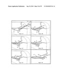 Enhanced Imaging Cartridge diagram and image