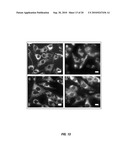 In vivo photodynamic therapy of cancer via a near infrared agent encapsulated in calcium phosphate nanoparticles diagram and image