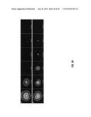 In vivo photodynamic therapy of cancer via a near infrared agent encapsulated in calcium phosphate nanoparticles diagram and image