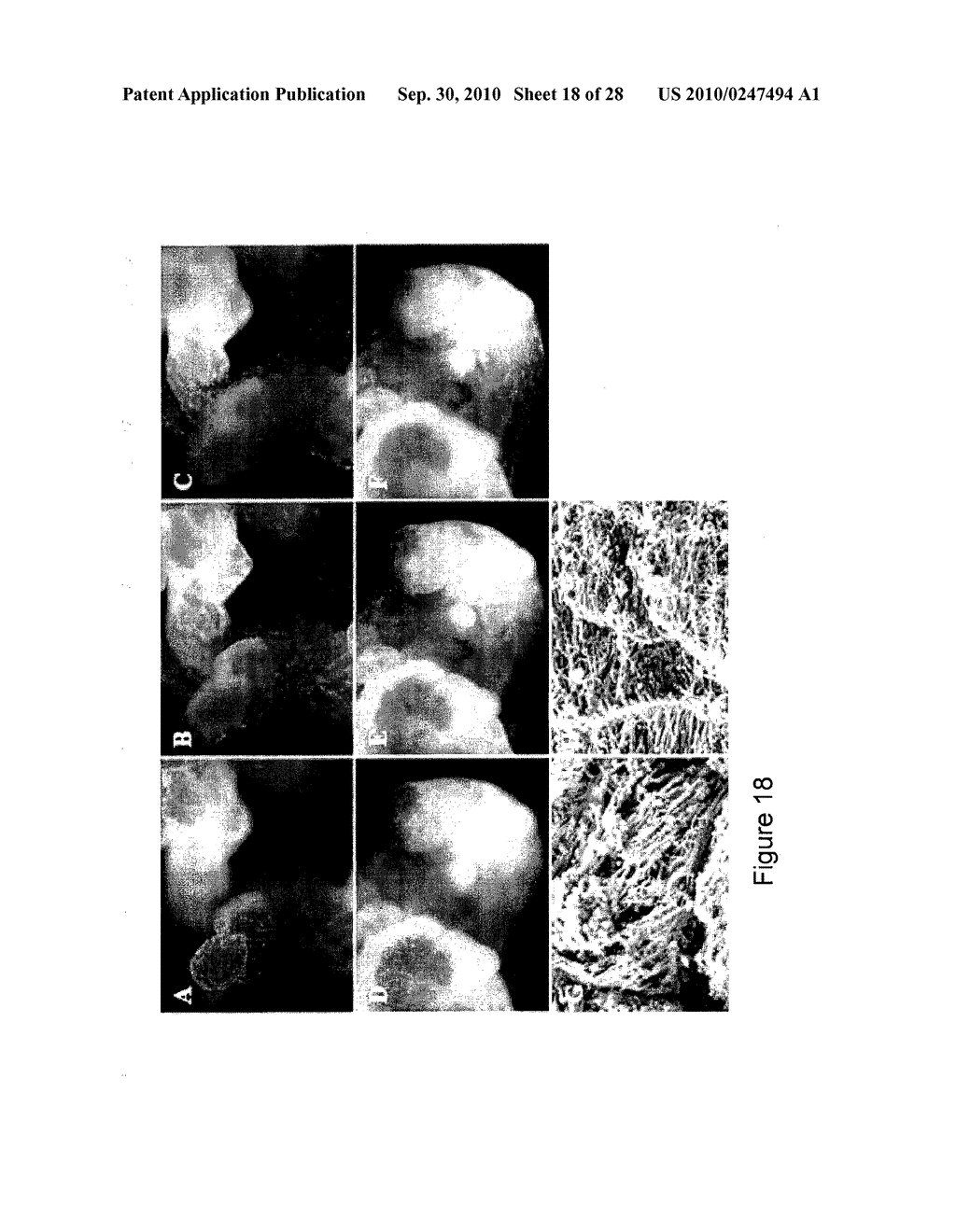 Compositions of Mesenchymal Stem Cells to Regenerate Bone - diagram, schematic, and image 19