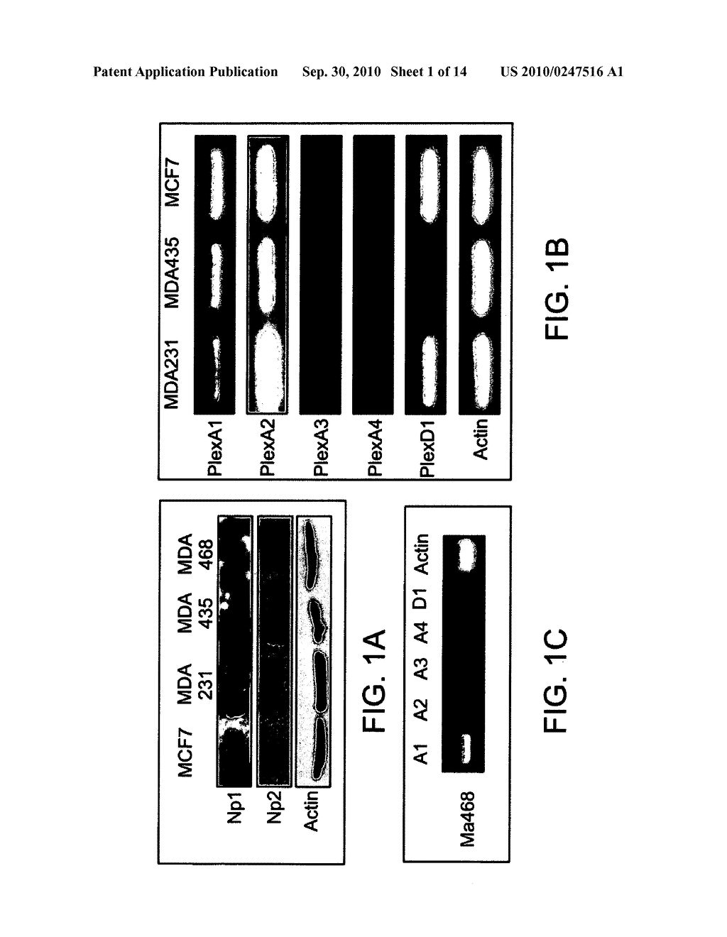 COMPOSITIONS COMPRISING SEMAPHORINS FOR THE TREATMENT OF ANGIOGENESIS RELATED DISEASES AND METHODS OF SELECTION THEREOF - diagram, schematic, and image 02