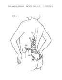 ELEMENT FOR IMPLANTATION WITH MEDICAL DEVICE diagram and image