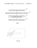 ELEMENT FOR IMPLANTATION WITH MEDICAL DEVICE diagram and image