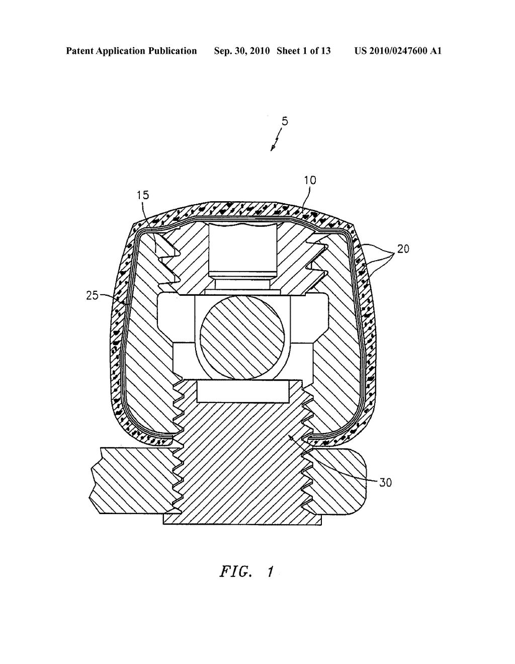 THERAPEUTIC DRUG ELUTING IMPLANT COVER AND METHOD OF MAKING THE SAME - diagram, schematic, and image 02