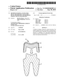 METHOD OF MAKING A FACING FOR A DENTAL RESTORATION, FACING FOR A DENTAL RESTORATION, AND METHOD OF MAKING A DENTAL RESTORATION diagram and image