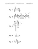 METHOD OF MAKING A FACING FOR A DENTAL RESTORATION, FACING FOR A DENTAL RESTORATION, AND METHOD OF MAKING A DENTAL RESTORATION diagram and image