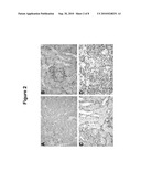 Tissue Rejection diagram and image