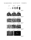 N-ACETYL MANNOSAMINE AS A THERAPEUTIC AGENT diagram and image