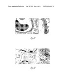 N-ACETYL MANNOSAMINE AS A THERAPEUTIC AGENT diagram and image