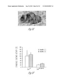 N-ACETYL MANNOSAMINE AS A THERAPEUTIC AGENT diagram and image