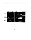 Botulinum neurotoxin a receptor and the use thereof diagram and image