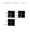 Botulinum neurotoxin a receptor and the use thereof diagram and image