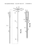 TWO-PIECE TRANSSEPTAL CANNULA, DELIVERY SYSTEM, AND METHOD OF DELIVERY diagram and image