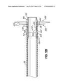 TWO-PIECE TRANSSEPTAL CANNULA, DELIVERY SYSTEM, AND METHOD OF DELIVERY diagram and image