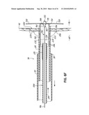 TWO-PIECE TRANSSEPTAL CANNULA, DELIVERY SYSTEM, AND METHOD OF DELIVERY diagram and image