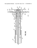 TWO-PIECE TRANSSEPTAL CANNULA, DELIVERY SYSTEM, AND METHOD OF DELIVERY diagram and image