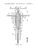 TWO-PIECE TRANSSEPTAL CANNULA, DELIVERY SYSTEM, AND METHOD OF DELIVERY diagram and image