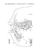 TWO-PIECE TRANSSEPTAL CANNULA, DELIVERY SYSTEM, AND METHOD OF DELIVERY diagram and image