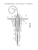 TWO-PIECE TRANSSEPTAL CANNULA, DELIVERY SYSTEM, AND METHOD OF DELIVERY diagram and image