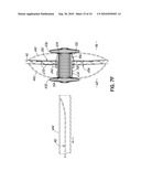 TWO-PIECE TRANSSEPTAL CANNULA, DELIVERY SYSTEM, AND METHOD OF DELIVERY diagram and image