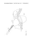 Access Device With Insert diagram and image