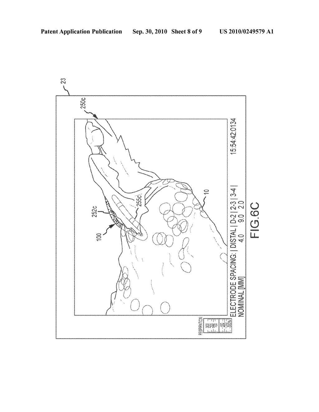 Systems and methods for modeling both unobstructed and obstructed portions of a catheter - diagram, schematic, and image 09