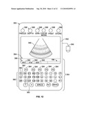 SYSTEM AND METHOD FOR DISPLAYING ULTRASOUND MOTION TRACKING INFORMATION diagram and image