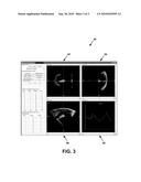 SYSTEM AND METHOD FOR AUTOMATIC CALIBRATION OF TRACKED ULTRASOUND diagram and image