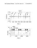 SEGMENTING A CARDIAC ACOUSTIC SIGNAL diagram and image