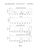 SEGMENTING A CARDIAC ACOUSTIC SIGNAL diagram and image