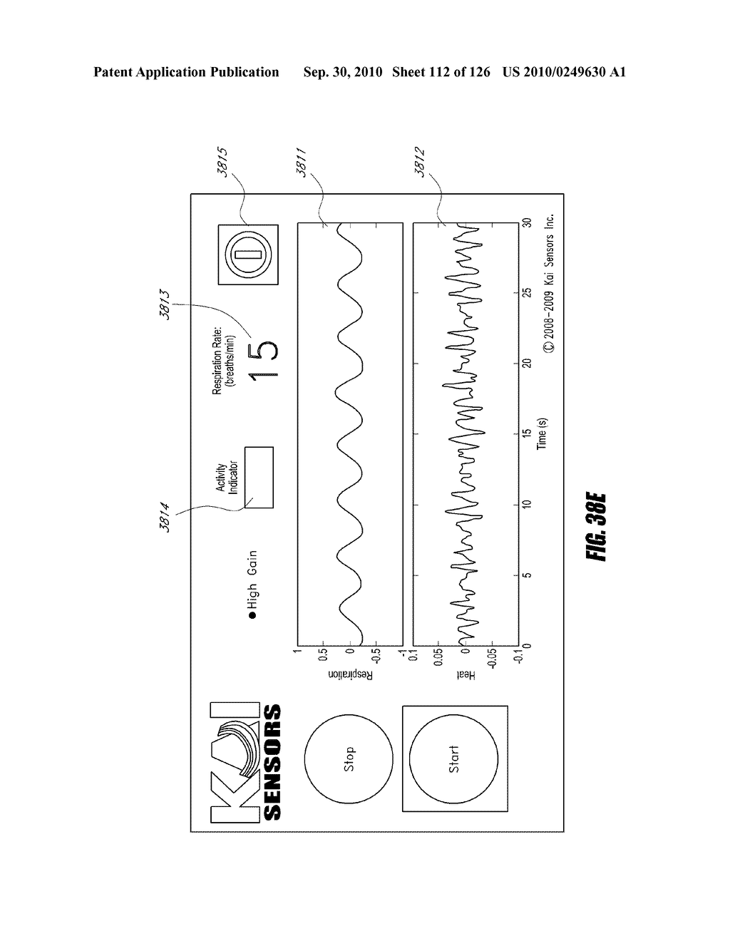 SYSTEMS AND METHODS FOR RESPIRATORY RATE MEASUREMENT - diagram, schematic, and image 114