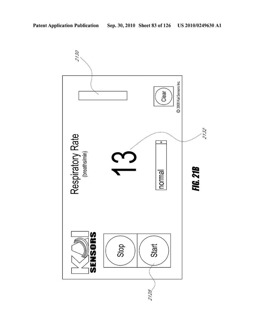 SYSTEMS AND METHODS FOR RESPIRATORY RATE MEASUREMENT - diagram, schematic, and image 85