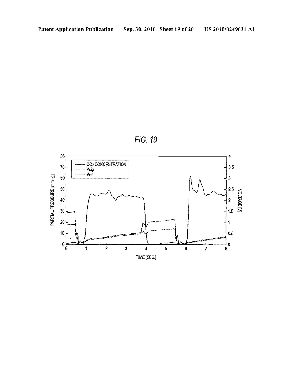 RESPIRATORY WAVEFORM ANALYZER - diagram, schematic, and image 20