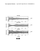 SYSTEMS AND METHODS FOR DETERMINING REGULARITY OF RESPIRATION diagram and image