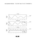 SYSTEMS AND METHODS FOR DETERMINING REGULARITY OF RESPIRATION diagram and image