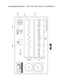 SYSTEMS AND METHODS FOR DETERMINING REGULARITY OF RESPIRATION diagram and image