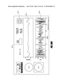 SYSTEMS AND METHODS FOR DETERMINING REGULARITY OF RESPIRATION diagram and image