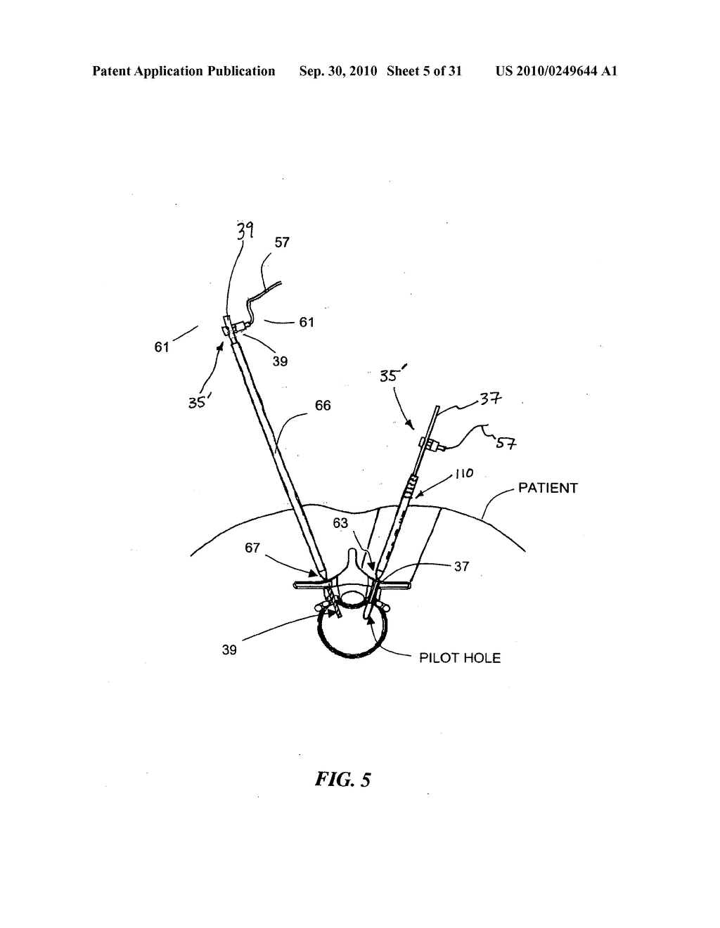 System and Methods for Performing Dynamic Pedicle Integrity Assessements - diagram, schematic, and image 06