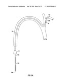 Variable Stiffness Guidewire Systems diagram and image