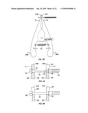 Variable Stiffness Guidewire Systems diagram and image