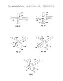 Variable Stiffness Guidewire Systems diagram and image