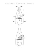 Variable Stiffness Guidewire Systems diagram and image