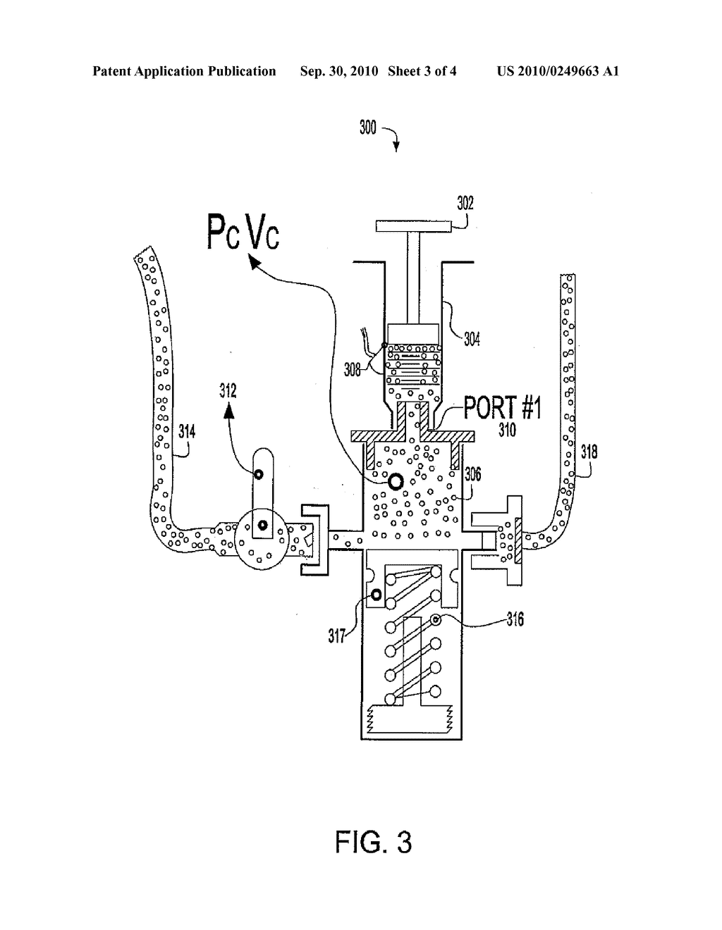 CONTINUOUS INTRA-ABDOMINAL PRESSURE MONITORING SYSTEM - diagram, schematic, and image 04