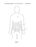 ULTRASONIC TREATMENT OF ADIPOSE TISSUE AT MULTIPLE DEPTHS diagram and image