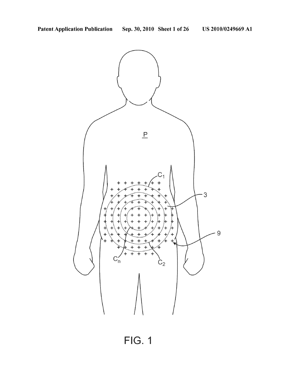 ULTRASONIC TREATMENT OF ADIPOSE TISSUE AT MULTIPLE DEPTHS - diagram, schematic, and image 02