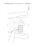 ULTRASONIC TREATMENT OF ADIPOSE TISSUE AT MULTIPLE DEPTHS diagram and image