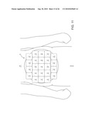 ULTRASONIC TREATMENT OF ADIPOSE TISSUE AT MULTIPLE DEPTHS diagram and image