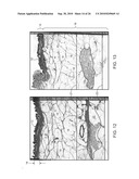 ULTRASONIC TREATMENT OF ADIPOSE TISSUE AT MULTIPLE DEPTHS diagram and image