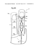 MOTION ASSIST APPARATUS diagram and image